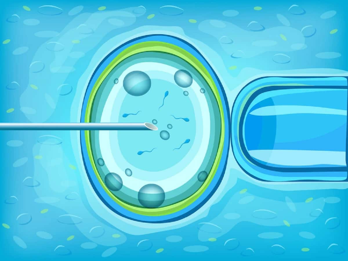 Fertility Treatment: A Few Things That You Should Take Care Of If You Are Considering IVF